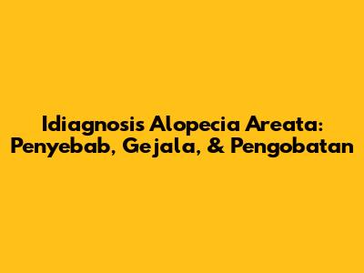 Idiagnosis Alopecia Areata: Penyebab, Gejala, & Pengobatan