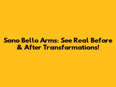 Sono Bello Arms: See Real Before & After Transformations!